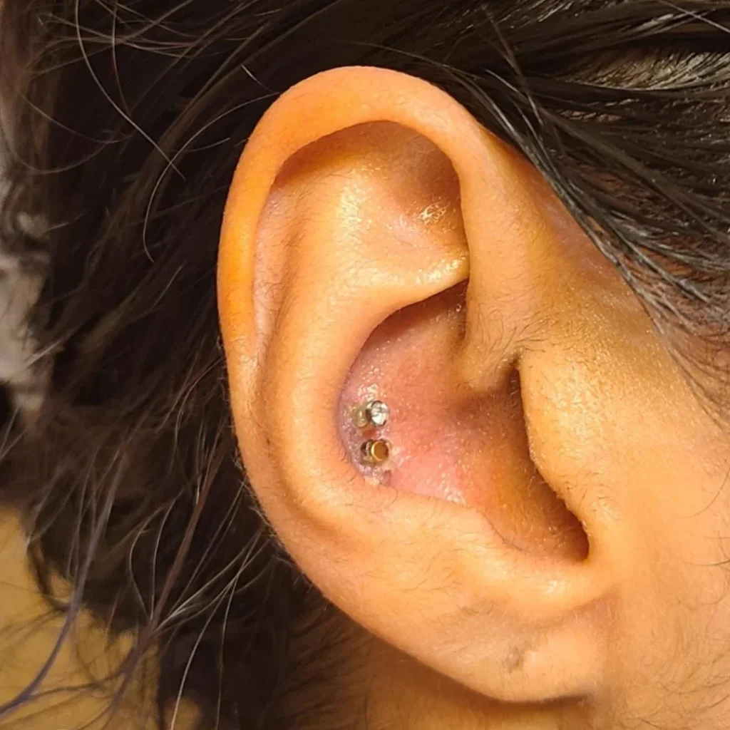 Double Conch Piercing Ideas For Men & Women